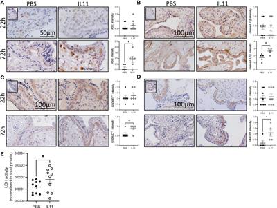 IL11 activates the placental inflammasome to drive preeclampsia